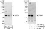 SSRP1 Antibody in Western Blot (WB)