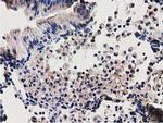 SSSCA1 Antibody in Immunohistochemistry (Paraffin) (IHC (P))