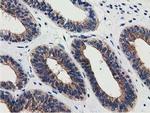 SSSCA1 Antibody in Immunohistochemistry (Paraffin) (IHC (P))