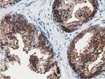 SSSCA1 Antibody in Immunohistochemistry (Paraffin) (IHC (P))