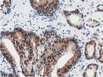 SSSCA1 Antibody in Immunohistochemistry (Paraffin) (IHC (P))