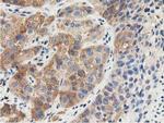 SSSCA1 Antibody in Immunohistochemistry (Paraffin) (IHC (P))