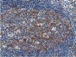 SSSCA1 Antibody in Immunohistochemistry (Paraffin) (IHC (P))