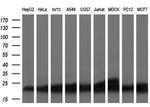 SSSCA1 Antibody in Western Blot (WB)