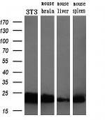SSSCA1 Antibody in Western Blot (WB)