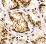 SSTR1 Antibody in Immunohistochemistry (IHC)