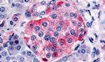 SSTR1 Antibody in Immunohistochemistry (Paraffin) (IHC (P))