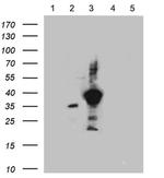 SSTR3 Antibody in Western Blot (WB)