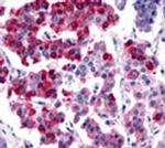 SSTR4 Antibody in Immunohistochemistry (IHC)