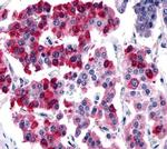 SSTR4 Antibody in Immunohistochemistry (Paraffin) (IHC (P))