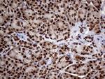 SSU72 Antibody in Immunohistochemistry (Paraffin) (IHC (P))