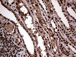 SSU72 Antibody in Immunohistochemistry (Paraffin) (IHC (P))