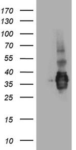SSU72 Antibody in Western Blot (WB)