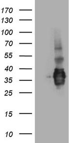 SSU72 Antibody in Western Blot (WB)