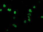 SSX1 Antibody in Immunocytochemistry (ICC/IF)