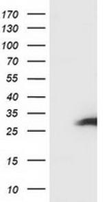 SSX1 Antibody in Western Blot (WB)