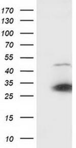 SSX1 Antibody in Western Blot (WB)