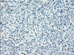 SSX2 Antibody in Immunohistochemistry (Paraffin) (IHC (P))