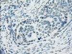 SSX2 Antibody in Immunohistochemistry (Paraffin) (IHC (P))