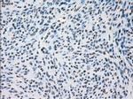 SSX2 Antibody in Immunohistochemistry (Paraffin) (IHC (P))
