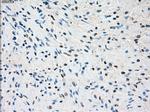 SSX2 Antibody in Immunohistochemistry (Paraffin) (IHC (P))