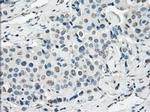 SSX2 Antibody in Immunohistochemistry (Paraffin) (IHC (P))