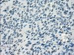 SSX2 Antibody in Immunohistochemistry (Paraffin) (IHC (P))