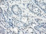 SSX2 Antibody in Immunohistochemistry (Paraffin) (IHC (P))