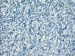 SSX2 Antibody in Immunohistochemistry (Paraffin) (IHC (P))