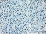SSX2 Antibody in Immunohistochemistry (Paraffin) (IHC (P))