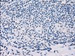SSX2 Antibody in Immunohistochemistry (Paraffin) (IHC (P))