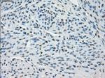 SSX2 Antibody in Immunohistochemistry (Paraffin) (IHC (P))