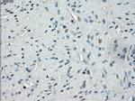 SSX2 Antibody in Immunohistochemistry (Paraffin) (IHC (P))