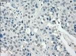 SSX2 Antibody in Immunohistochemistry (Paraffin) (IHC (P))