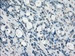 SSX2 Antibody in Immunohistochemistry (Paraffin) (IHC (P))
