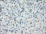 SSX2 Antibody in Immunohistochemistry (Paraffin) (IHC (P))