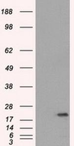 SSX2 Antibody in Western Blot (WB)