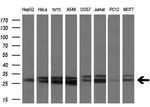 SSX2 Antibody in Western Blot (WB)