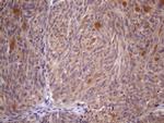SSX2IP Antibody in Immunohistochemistry (Paraffin) (IHC (P))