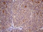 SSX2IP Antibody in Immunohistochemistry (Paraffin) (IHC (P))