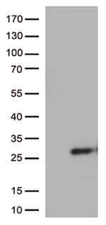 SSX4B Antibody in Western Blot (WB)