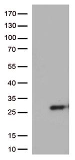 SSX4B Antibody in Western Blot (WB)
