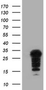 SSX5 Antibody in Western Blot (WB)