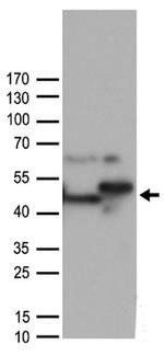 ST13 Antibody in Western Blot (WB)