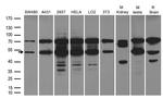 ST13 Antibody in Western Blot (WB)