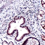 HIP Antibody in Immunohistochemistry (IHC)