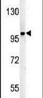 ST18 Antibody in Western Blot (WB)