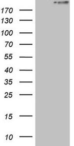 STAB2 Antibody in Western Blot (WB)