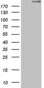 STAB2 Antibody in Western Blot (WB)