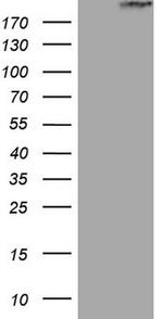 STAB2 Antibody in Western Blot (WB)
